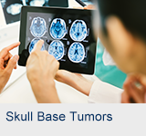 Skull Base Tumors | Advanced ENT Services